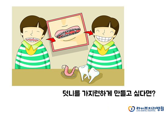 덧니교정 잘하는 부평치과 관련 이미지 2