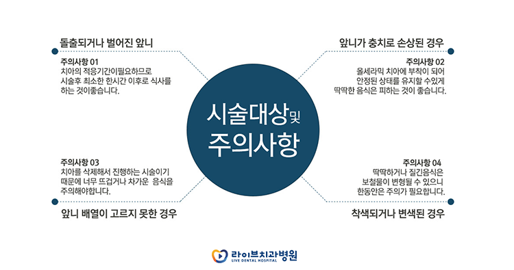 라미네이트 치료 과정이 뭘까요? 관련 이미지 5