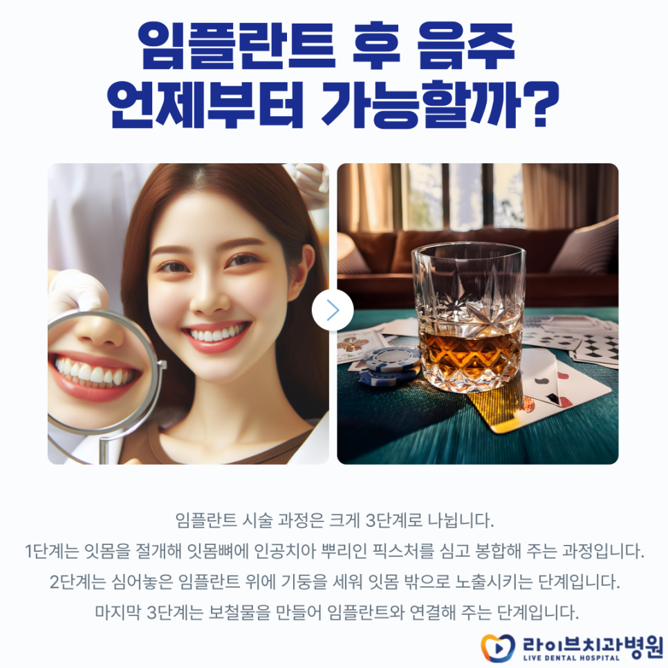 임플란트 수술 후 음주 언제부터? 관련 이미지 2