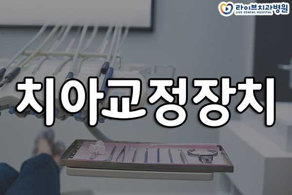 치아교정장치 선택하기 어렵다면 관련 이미지 1
