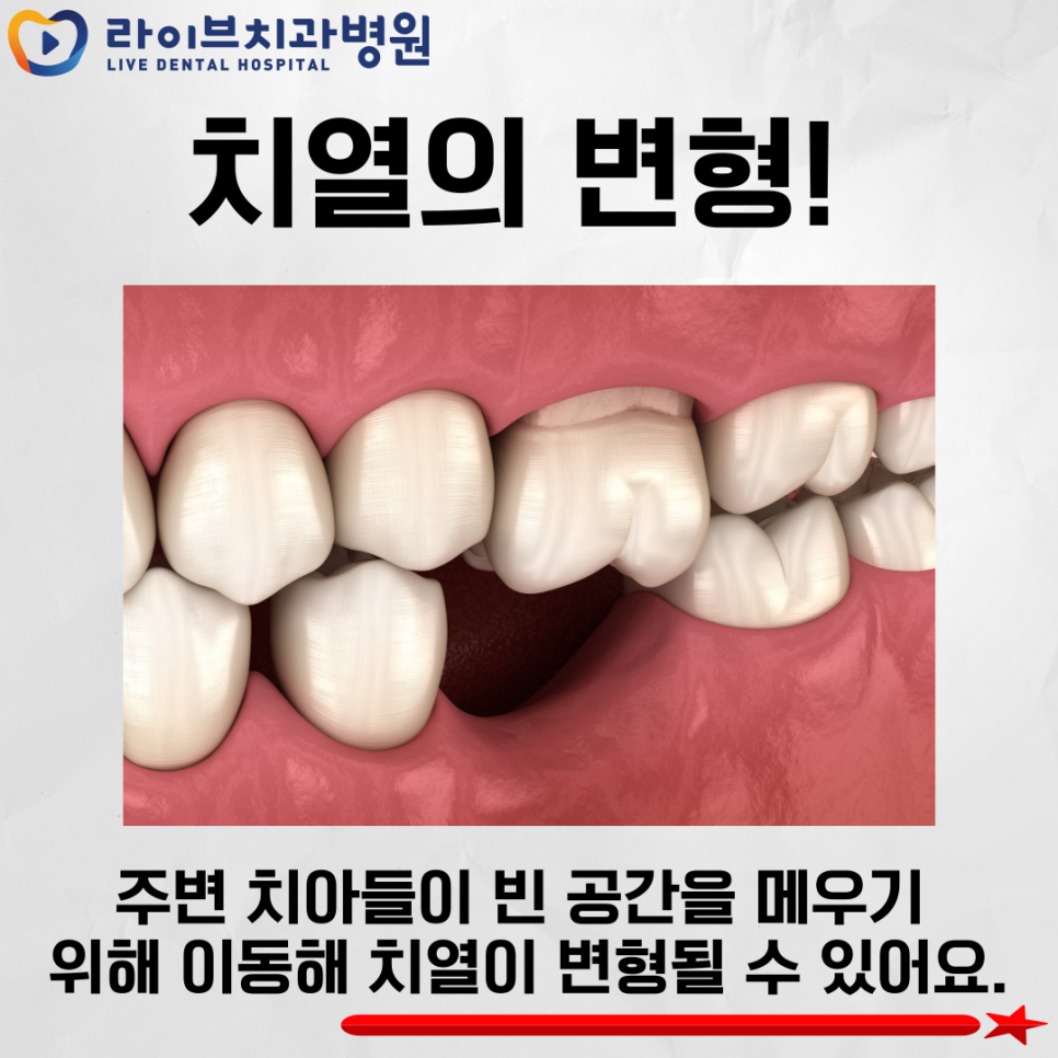 치아 상실 방치하면 부작용이?! 관련 이미지 3