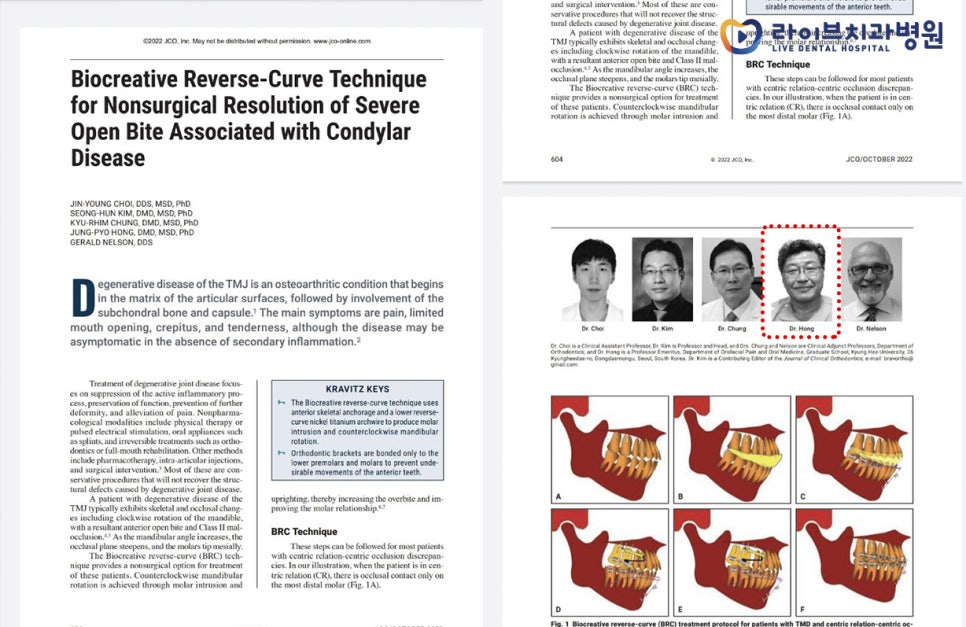 라이브치과 홍정표 교수님 관련 이미지 2