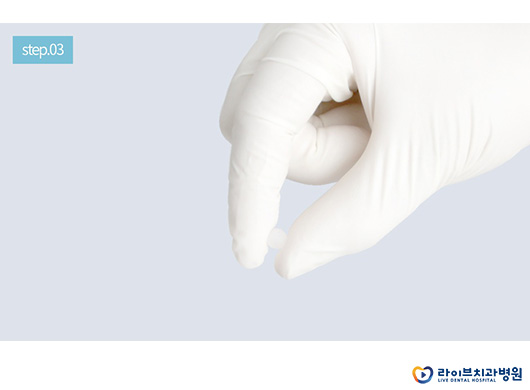 라이브하게 알아보는 교정용 왁스 사용법 관련 이미지 5