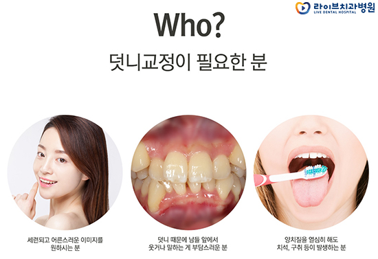 덧니교정 알아보고 계신가요? 관련 이미지 3