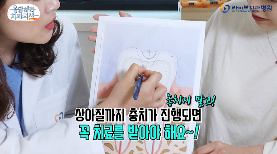 충치치료 시기를 놓치면 어떻게 되나요?! [응답하라치과의사 보존치료편] 관련 이미지 2