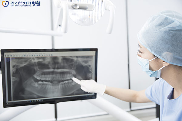 상악동거상술 꼭 받아야 되는걸까요? 관련 이미지 3