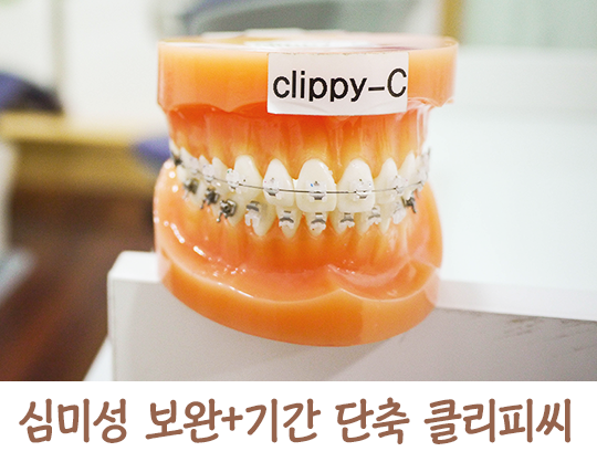 교정기의 종류에 대해 알아보자! 관련 이미지 4