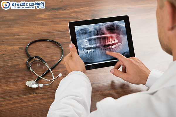 앞니임플란트 심미성을 되찾자 관련 이미지 2