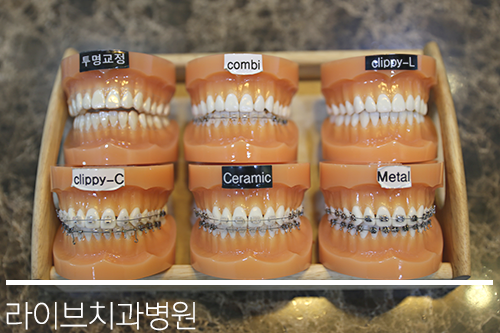 다양한 교정기의 종류들! 관련 이미지 2