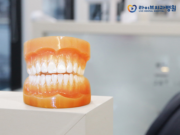 치아교정장치, 장점과 단점은 무엇일까요? 관련 이미지 5