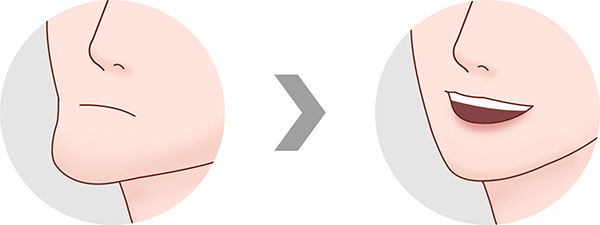 주걱턱교정, 교합을 바로잡는 비수술 솔루션! 관련 이미지 3