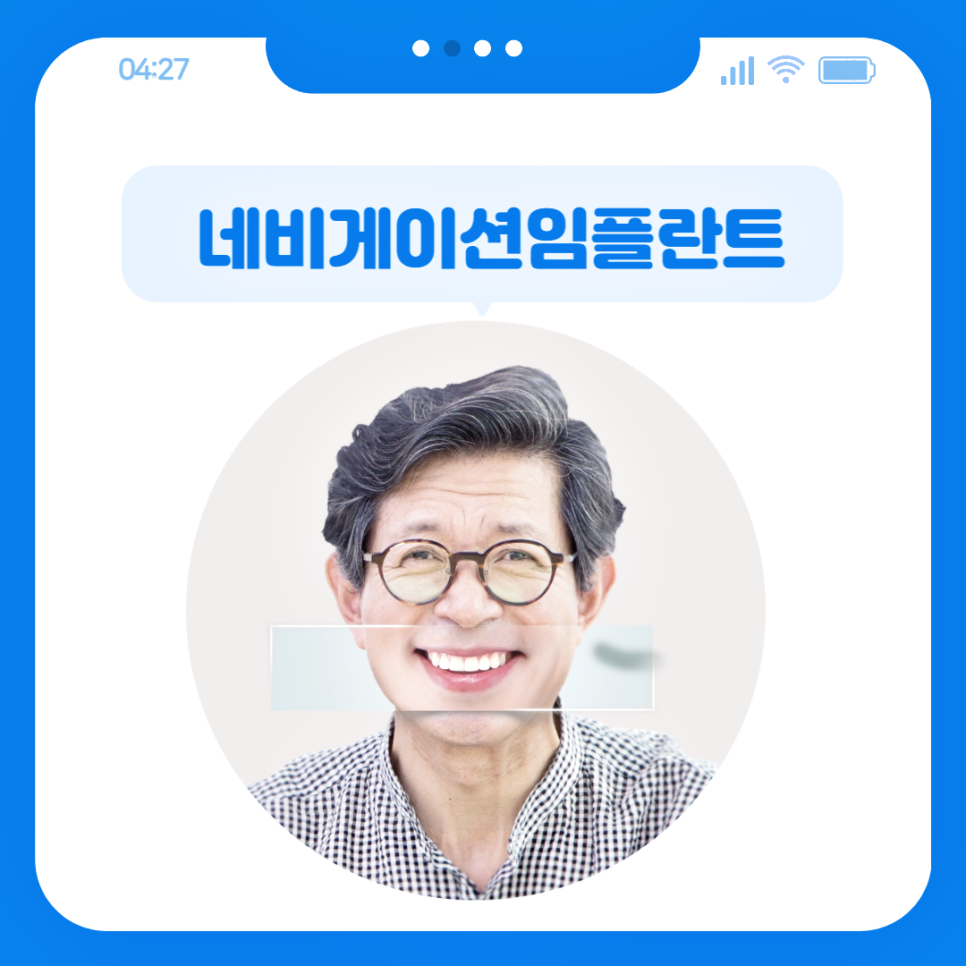 네비게이션임플란트 꼼꼼한 치료가 필요할 때 관련 이미지 2