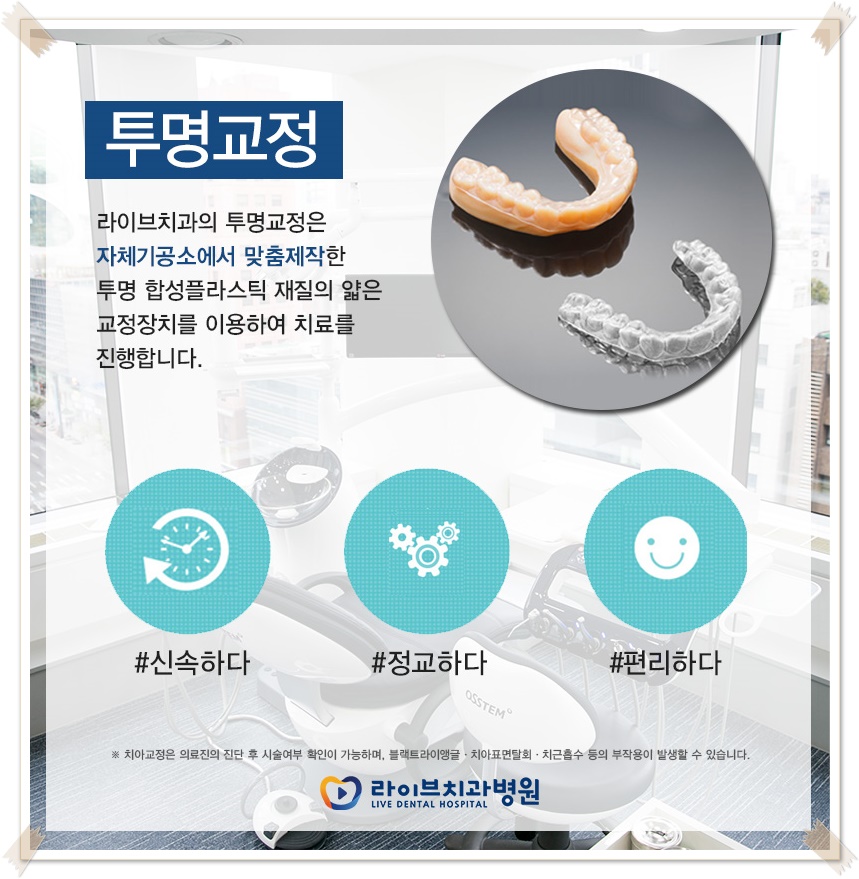 치아교정종류 상황에 맞게! 관련 이미지 8
