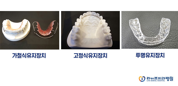 치아교정치과 선택법 TOP5 관련 이미지 7