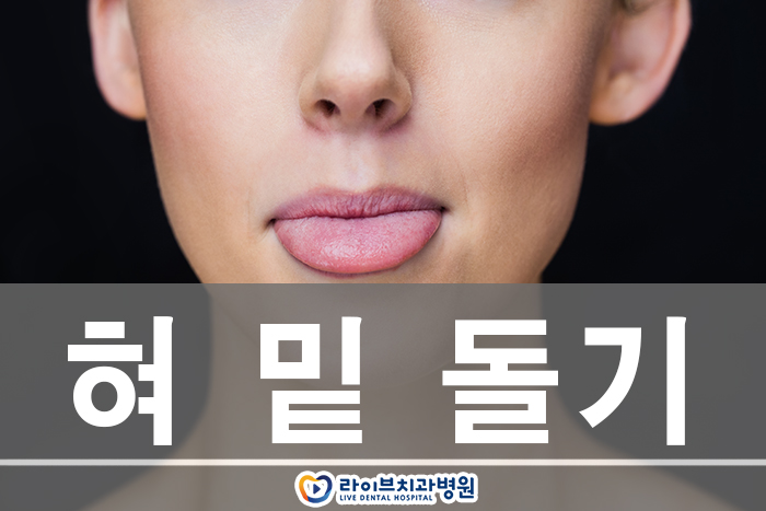혀 밑 돌기 왜 생기는건가요 관련 이미지 1