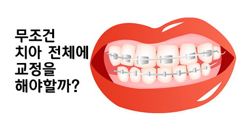 필요한 치아만 부분교정할 수 없을까? 관련 이미지 3