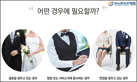 투명교정, 티나지 않는 교정을 원한다면? 관련 이미지 4