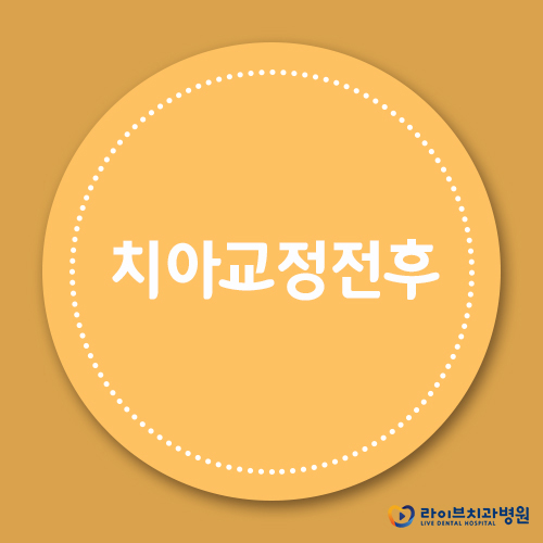 치아교정전후, 얼마나 달라질 수 있을까? 관련 이미지 1