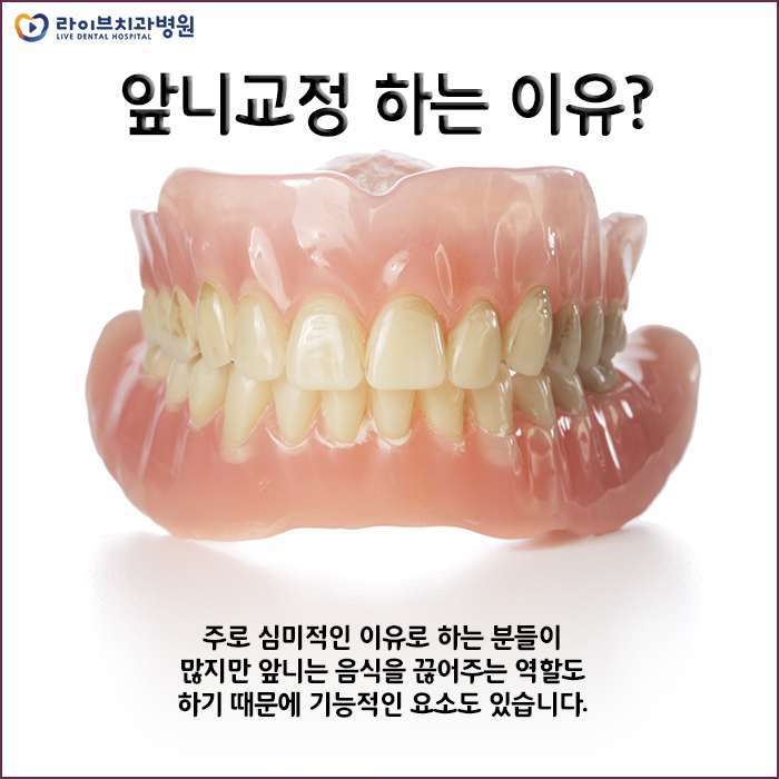 앞니교정, 부담없이 부분적으로 개선해보자 관련 이미지 3