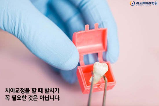 발치교정, 비발치교정이 결정되는 요인은? 관련 이미지 2