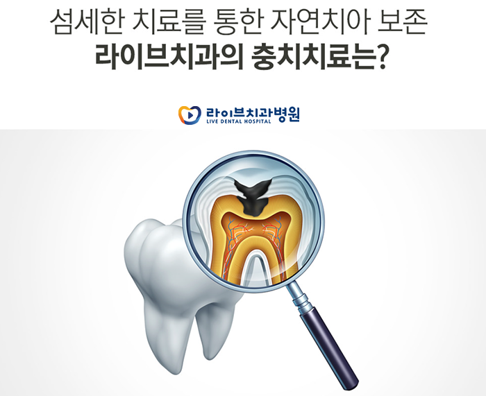 충치치료 후 통증 왜 아픈걸까요 관련 이미지 2