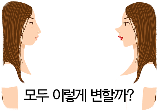 치아교정전후, 변화는 같을 수 없다? 관련 이미지 3