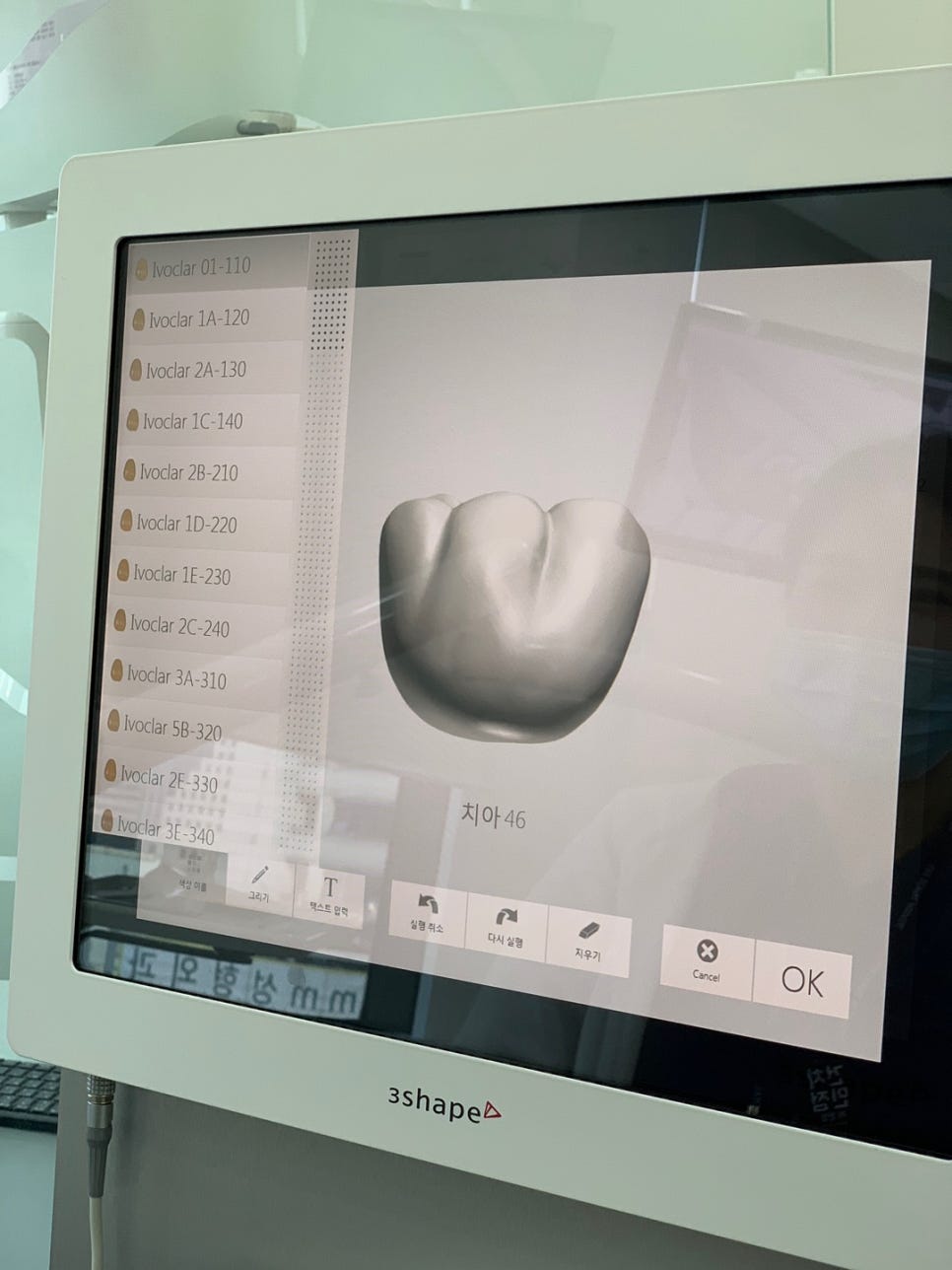 라이브치과병원 진료실에 구강스캐너 트리오스 3(TRIOS 3)가 들어왔습니다~ 관련 이미지 6
