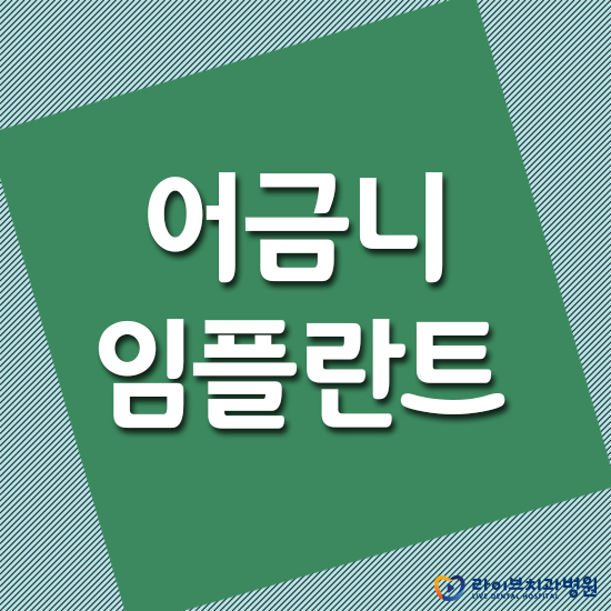 어금니임플란트 자세히 알아보고 시작하자 관련 이미지 1