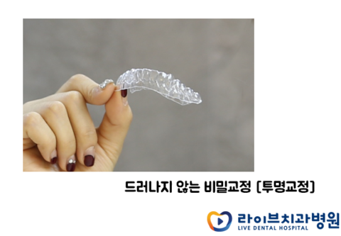 투명치아교정으로 찾는 자신감 관련 이미지 4