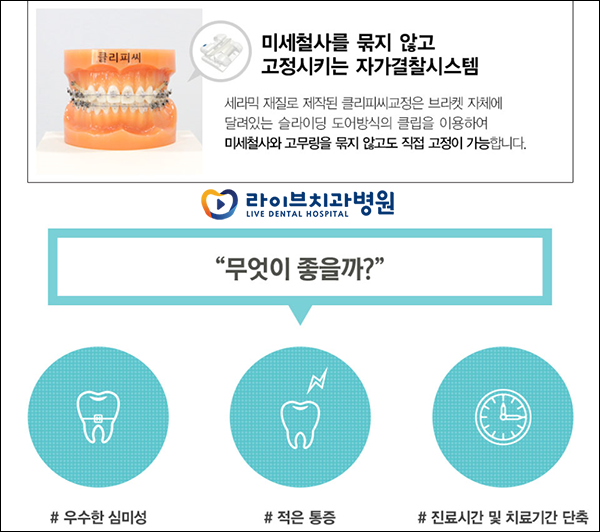 클리피씨교정 가격부터 장단점까지 관련 이미지 4