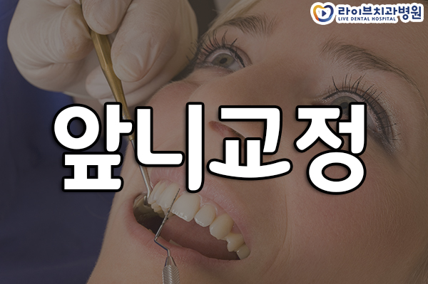 앞니교정 가지런하게 개선하자 관련 이미지 1