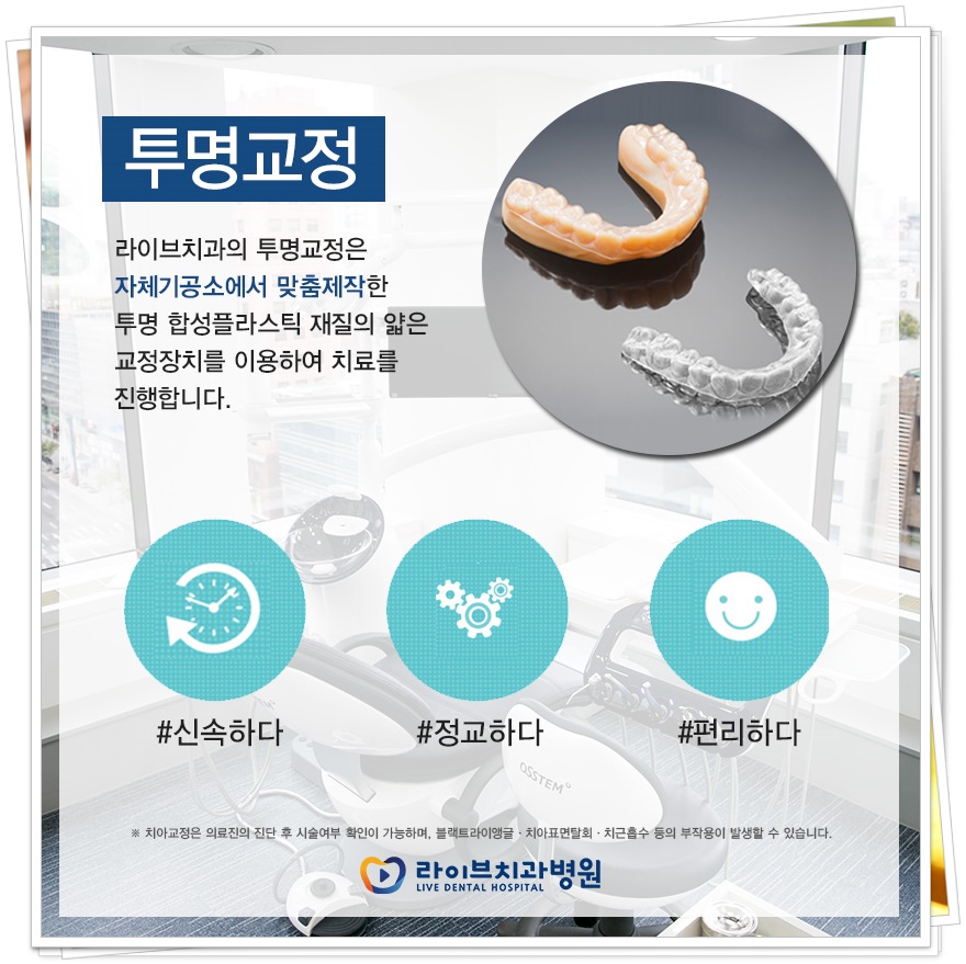치아교정기 종류 원하는 목적에 맞게 관련 이미지 5