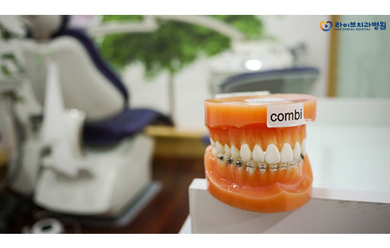 교정기 종류, 그것이 알고 싶다! 관련 이미지 7