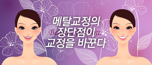 내구성과 비용을 잡는 메탈교정 관련 이미지 5