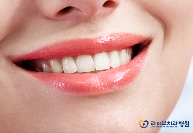 앞니임플란트, 미소에 자신감을 채워요! 관련 이미지 2