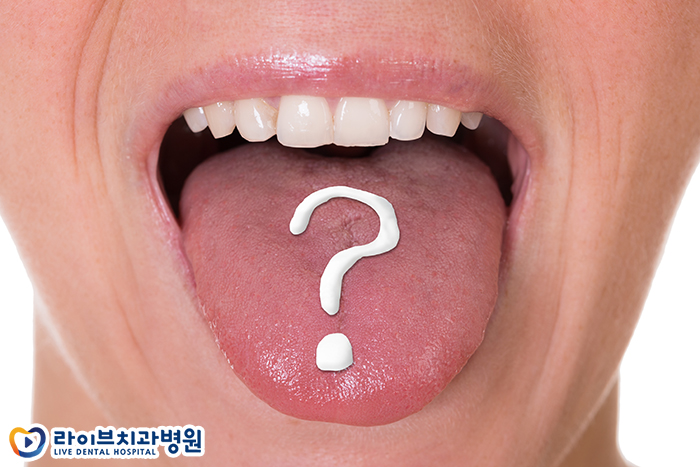 혀에 검은점이 났다면? 관련 이미지 2