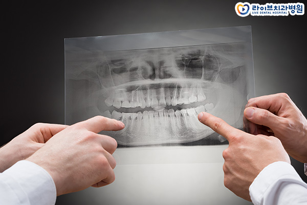 아랫니교정 받을 수 있을까요? 관련 이미지 3