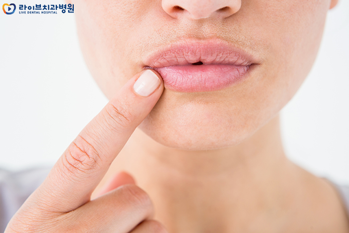 입술 갈라짐 원인이 뭘까? 관련 이미지 3