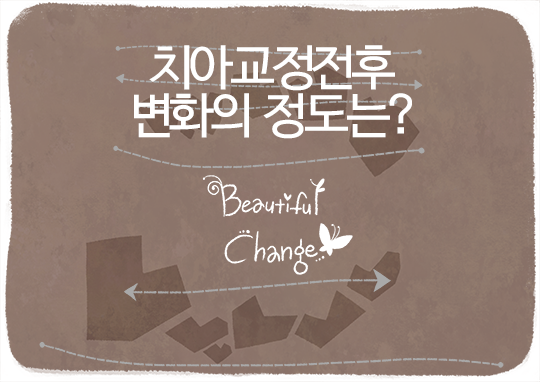 치아교정전후, 변화는 같을 수 없다? 관련 이미지 2