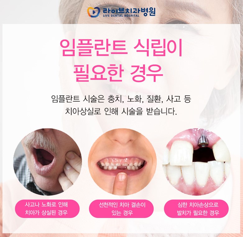 인천 임플란트 찾고 있다면 라이브 치과가 정답이다^^ 관련 이미지 1