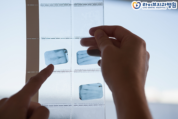 임플란트잘하는치과 선택하려면 관련 이미지 2