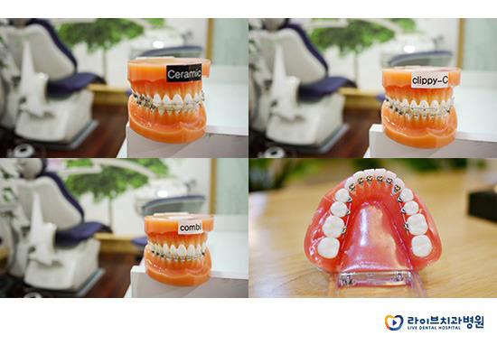 인천치아교정, 접근성과 전문성을 다잡다 관련 이미지 5