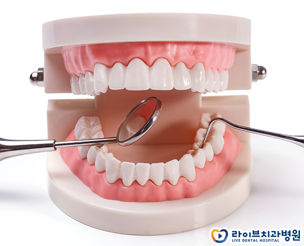 치아교정비용 부담없이 합리적으로 관련 이미지 3