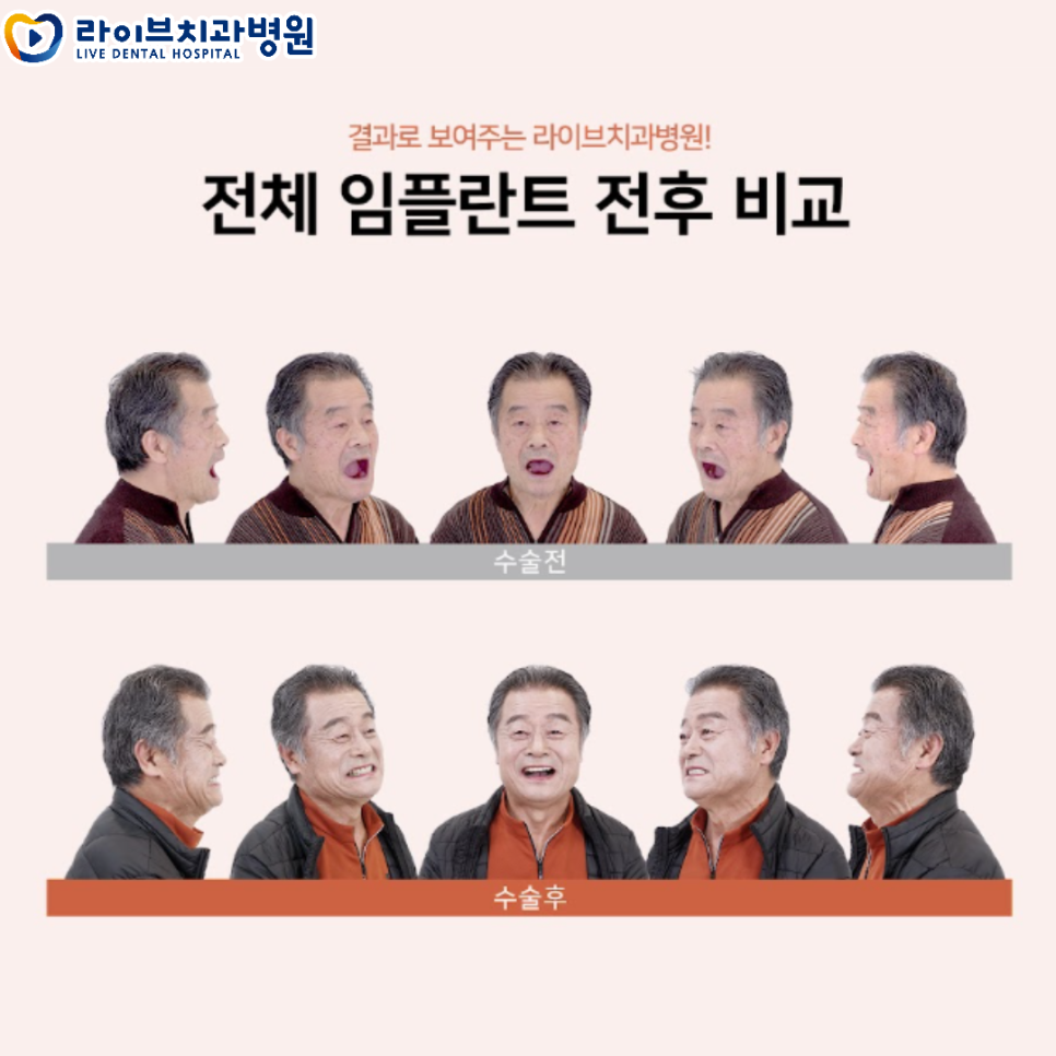 라이브치과병원 리얼스토리 전후 사진! 관련 이미지 1