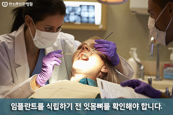 상악동거상술 궁금한 점에 대해 알아보자 관련 이미지 2