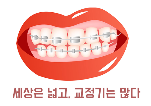 교정기의 다양한 종류를 알아보자! 관련 이미지 2