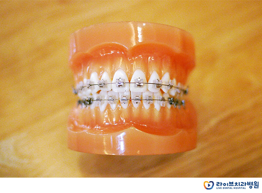 클리피씨교정으로 빠르게 찾는 자신감 관련 이미지 2