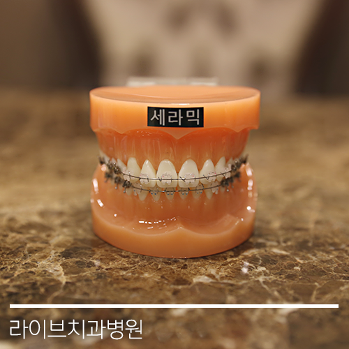 다양한 교정기의 종류들! 관련 이미지 4