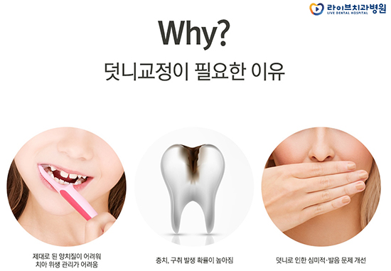 덧니교정 알아보고 계신가요? 관련 이미지 2