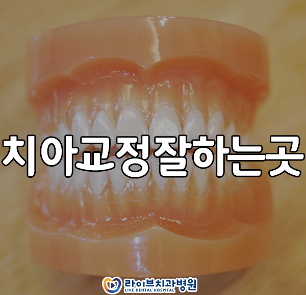 치아교정잘하는곳 궁금하신가요? 관련 이미지 1